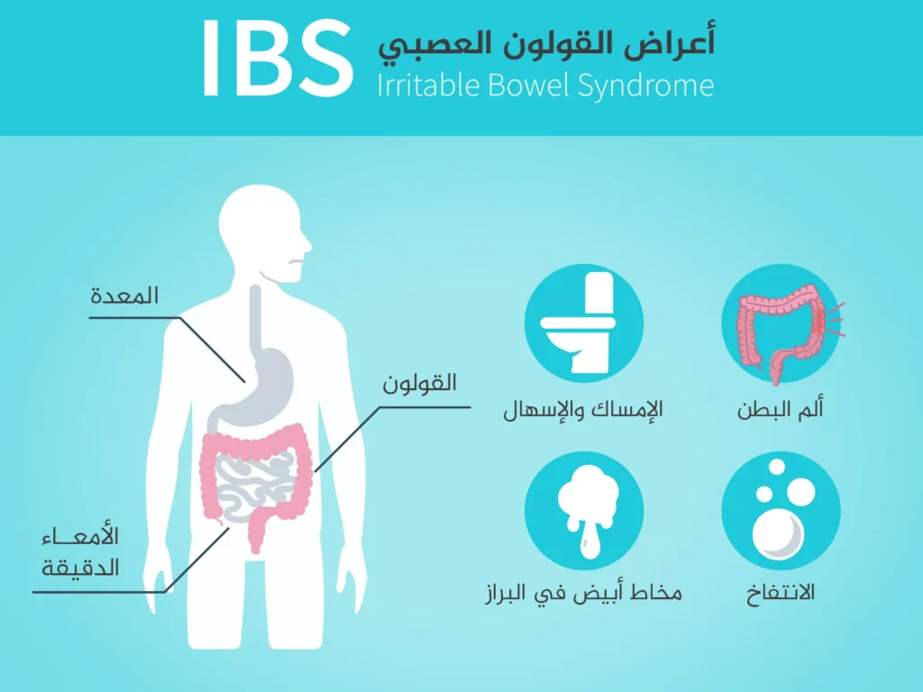 علاج القولون العصبي : الدليل الشامل للتعامل مع هذا الاضطراب